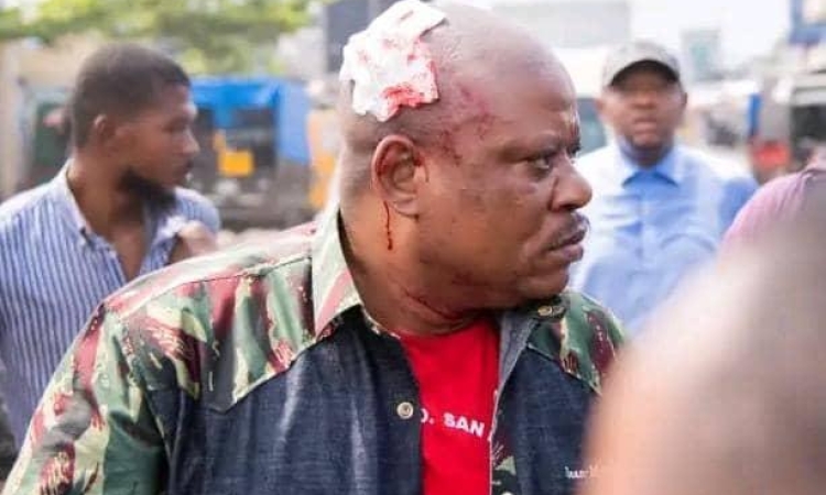 URGENT : l’Opposant Jean-Marc KABUND échappe à la mort au Camp Luka !